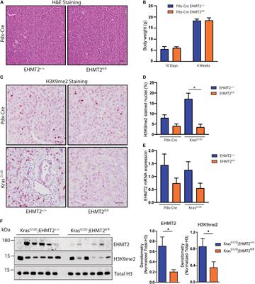 Inactivation of the Euchromatic Histone-Lysine N-Methyltransferase 2 Pathway in Pancreatic Epithelial Cells Antagonizes Cancer Initiation and Pancreatitis-Associated Promotion by Altering Growth and Immune Gene Expression Networks